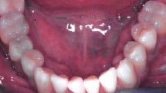 General Dentistry Patient After