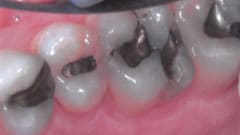 General Dentistry Patient Before