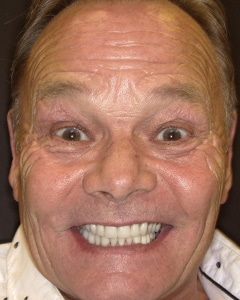 Full Face view of a male patient of Dr. Rod Strober after dental treatment
