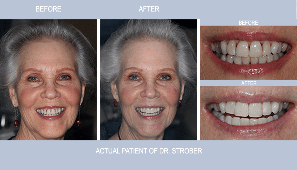BioClear Patient Before and After