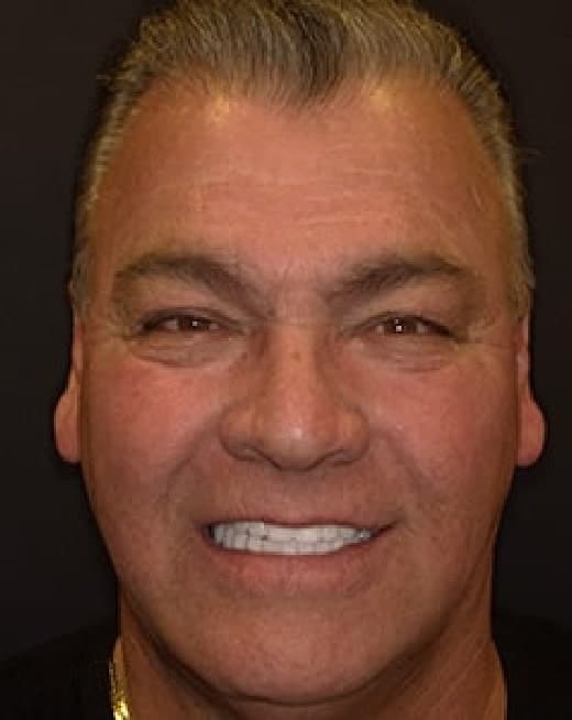 male dental patient of Dr. Rod Strober shows off his smile transformation