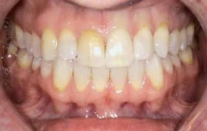 Patient Profile at Country Club Dentistry in Rancho Mirage CA