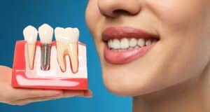 Dentist consulting with patient about dental implants for restorative dentistry