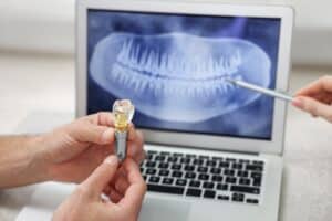 Doctor showing a patient their CEREC crown digital imaging for same-day treatment